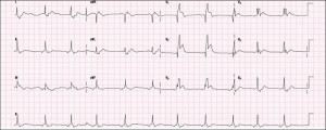 ECG - Not mine I hasten to add - mine has added features!